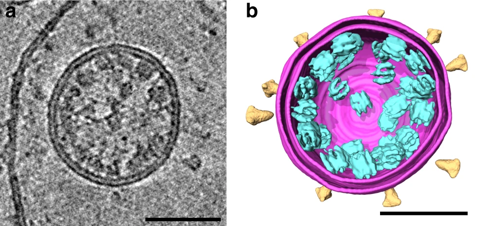 Elektronentomogramm des Virus SARS-CoV-2 und 3D-Rekonstruktion